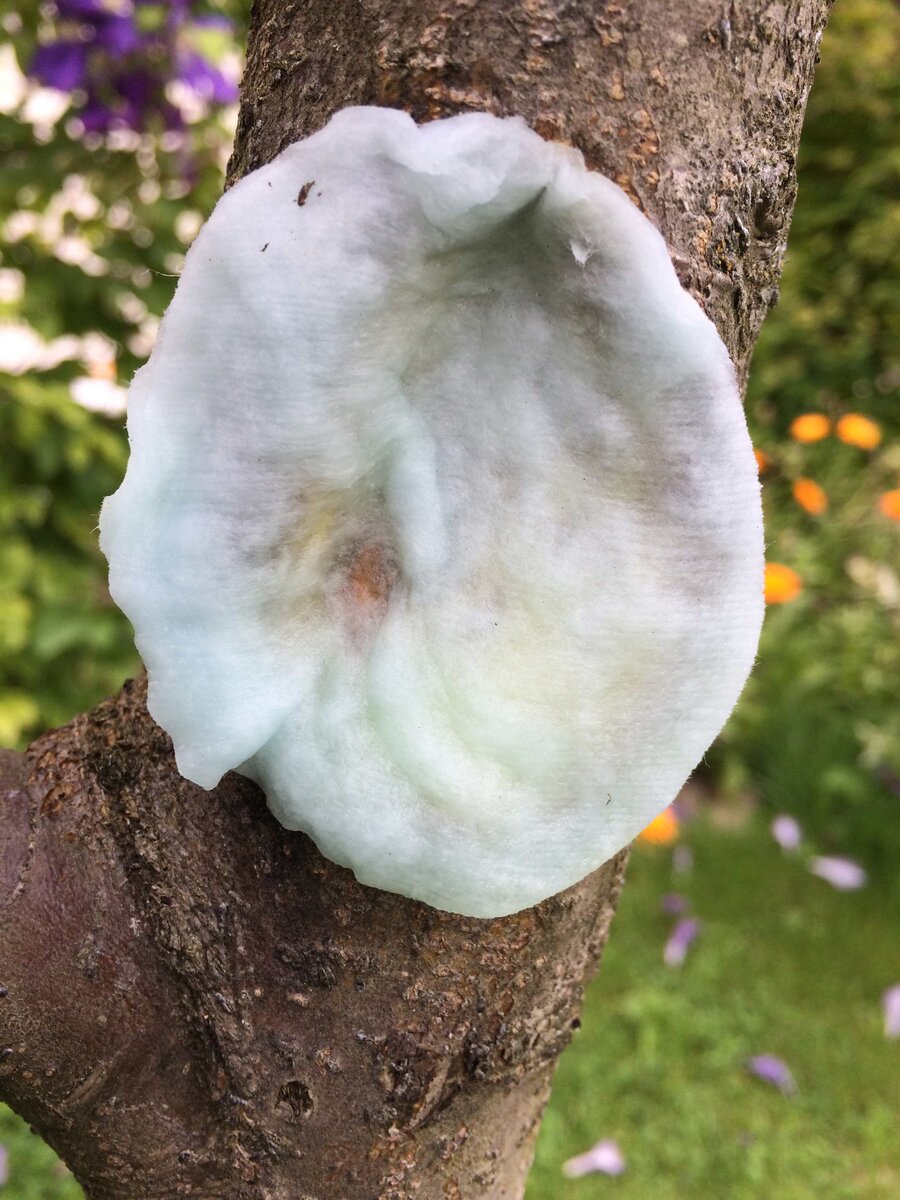 Ватный тампон с медным купоросом в буквальном смысле прилип к ранке.