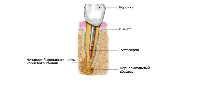 Схема