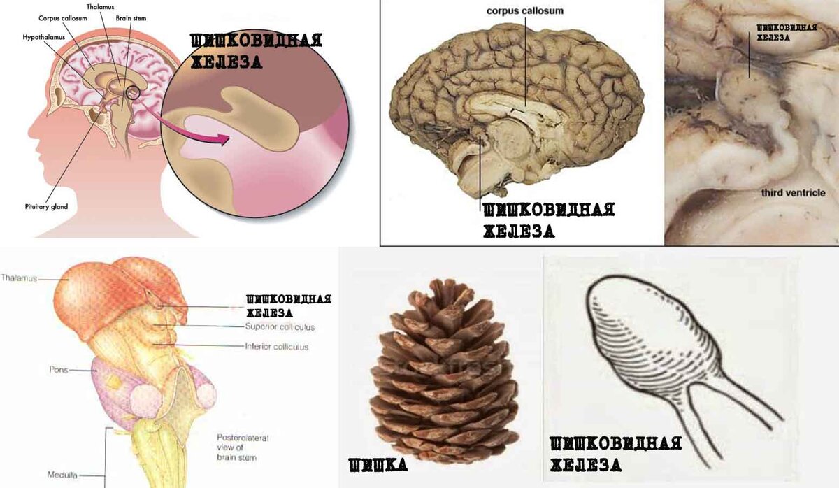 Мозги шишковидная железа