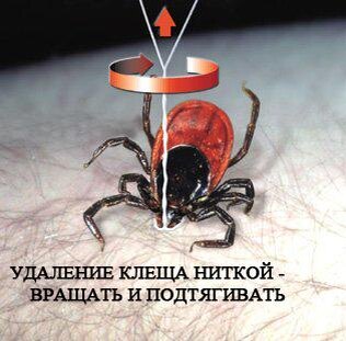   Если присасывание клеща все же произошло, первичную консультацию всегда можно получить по телефону 03.
