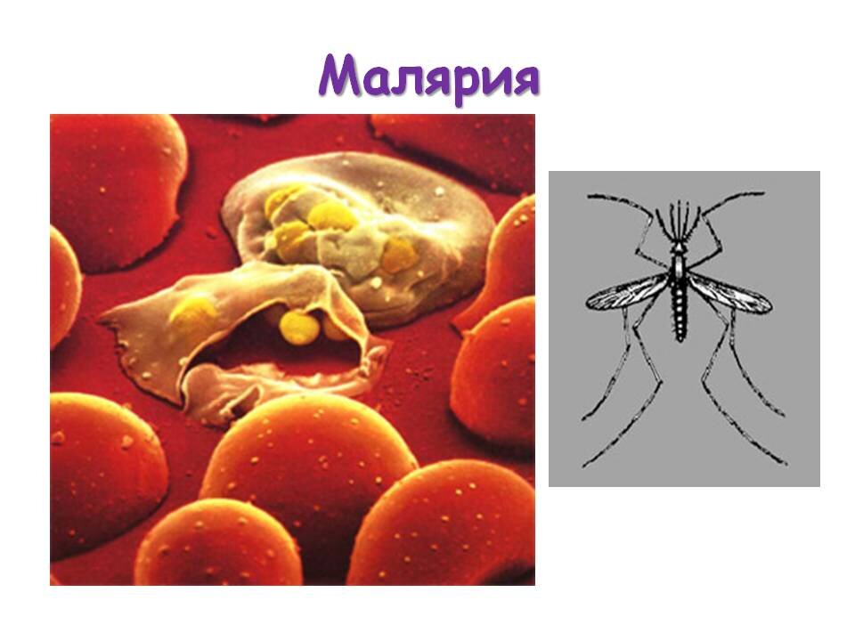 Малярия у детей презентация