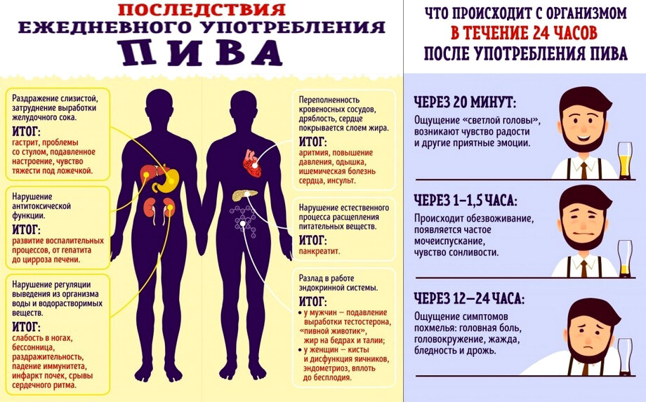 Последствия ежедневного употребления пива