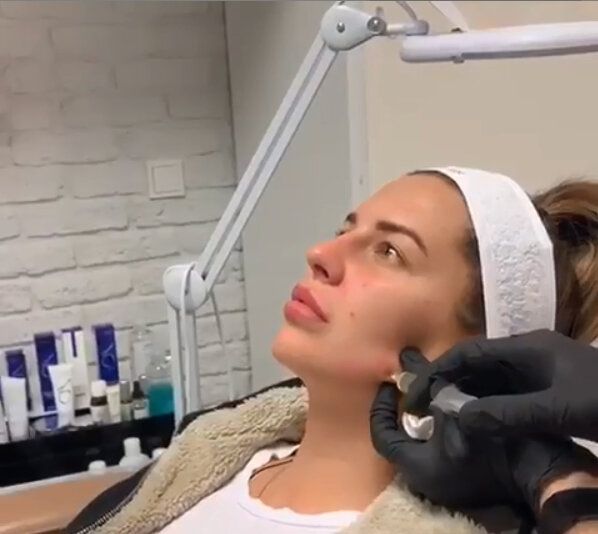 Донцовой вкололи липолитики
Фото: "Инстаграм"