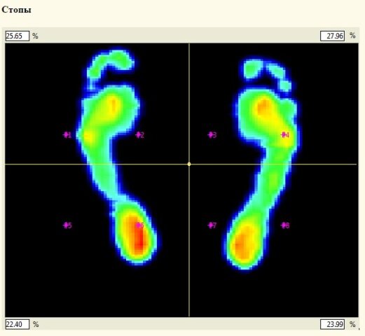 Распределение нагрузки на стопы