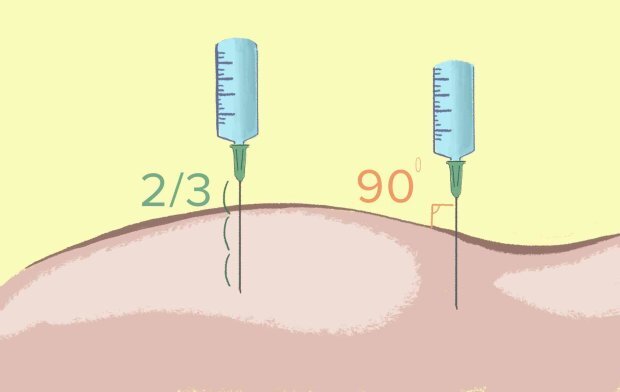 Куда правильно делать укол в ягодицу фото
