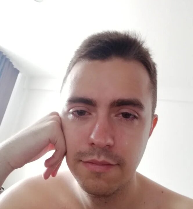 Мой болезненный вид после операции