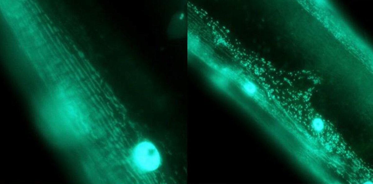 Мышечная ткань нематод C. elegans. Слева – нормальные митохондрии, интегрированные в сети; справа - фрагментированные митохондрии в патологически измененном органе. Окраска зеленым флуоресцентным белком