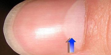 Источник изображения: http://sarcasm.co/wp-content/uploads/2018/03/fig5-360x180.jpg