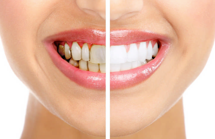 все фото взяты из открытых источников