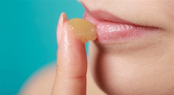 Заеды в уголках рта или ангулит - почему появляются и как лечить?