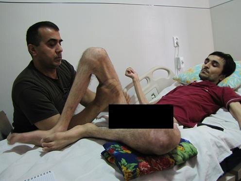 Фуркат Ахмедов делает Шахболу массаж. Фото Тилава Расул-заде