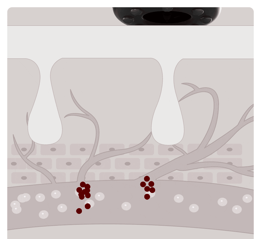 Промо gif анимация процесса удаления шлаков и токсинов умного электрического мини-массажера xiaomi leravan - LF-RSW-328-MWH. Фото из свободного доступа.