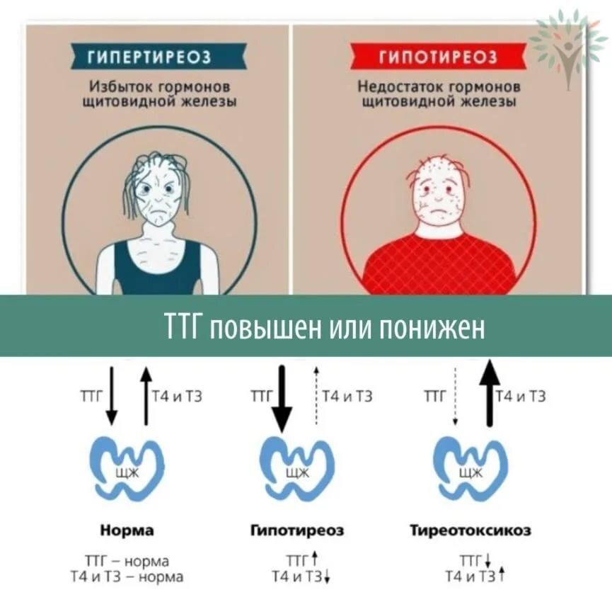 Может быть повышен. Гипотиреоз показатели ТТГ т3 и т4. Гипотиреоз при нормальном ТТГ т3 т4. Нормы показателей гормонов щитовидной железы. Т3 4 гормоны щитовидной.