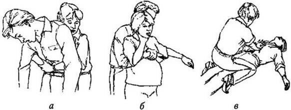 Прием геймлиха беременным. Оказание помощи при обструкции дыхательных путей прием Хеймлиха. Прием Геймлиха при обструкции дыхательных путей. Обструкция дыхательных путей инородным телом. Обструкция дыхательных путей инородным телом у детей.