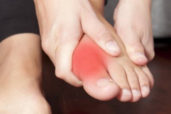 воспаление сустава