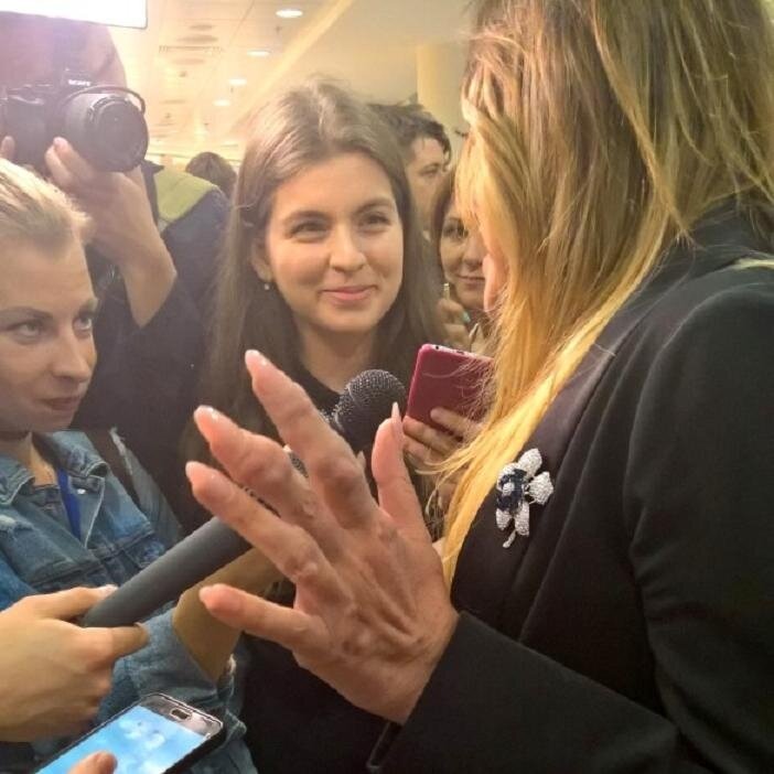 Юлия началова фото рук и ног Юлия Началова впервые показала шишки на руках от подагры ШОУБИЗ НАИЗНАНКУ Дзен