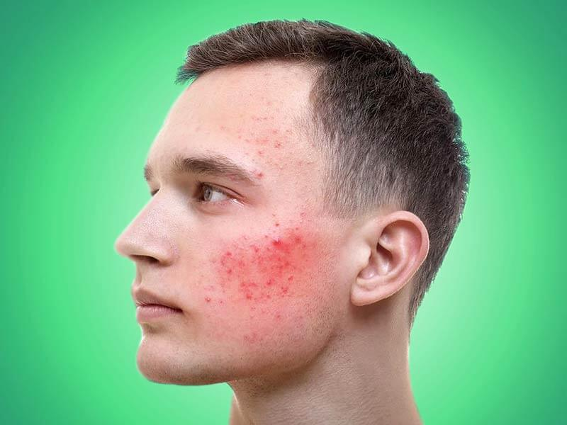 Фото взято с сайта www.lifealth.com