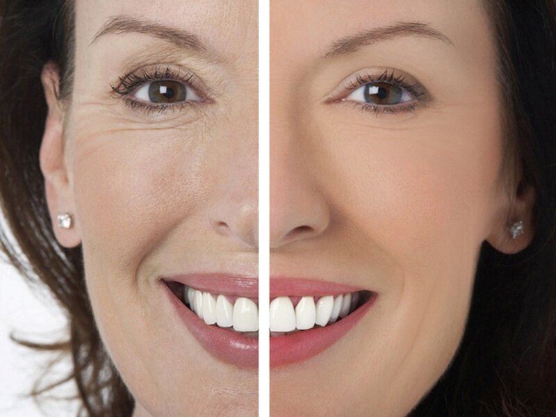 Источник картинки: vashamaska.ru 