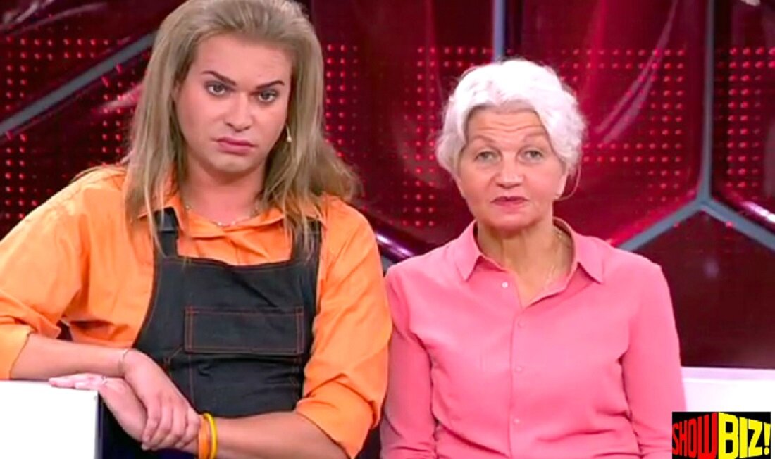 фото до пластической операции.