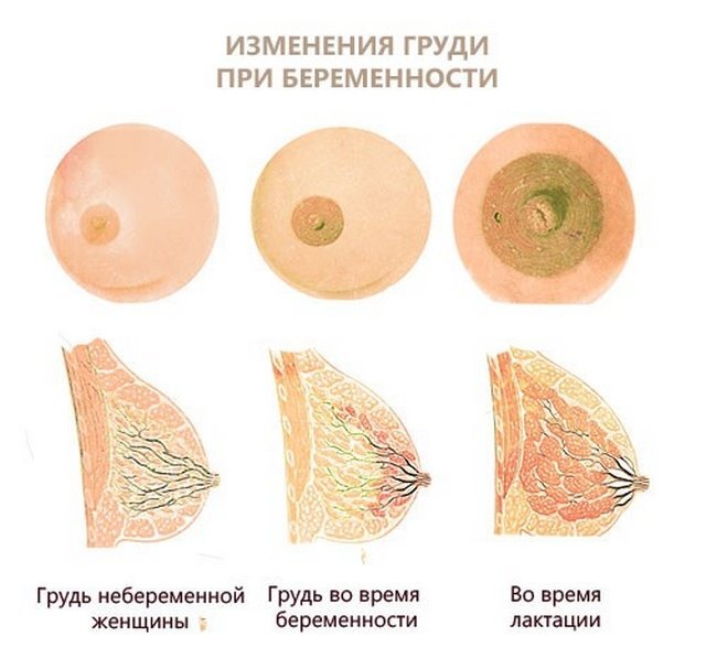 Размеры ареол у женской груди и их виды