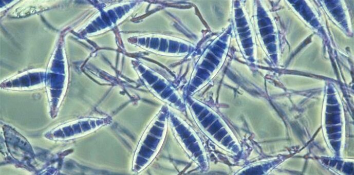 Споры лишая под микроскопом