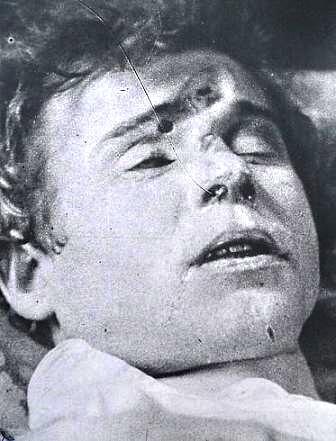 Голова трупа Есенина