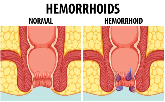 Фото: Фрипик/ brgfx