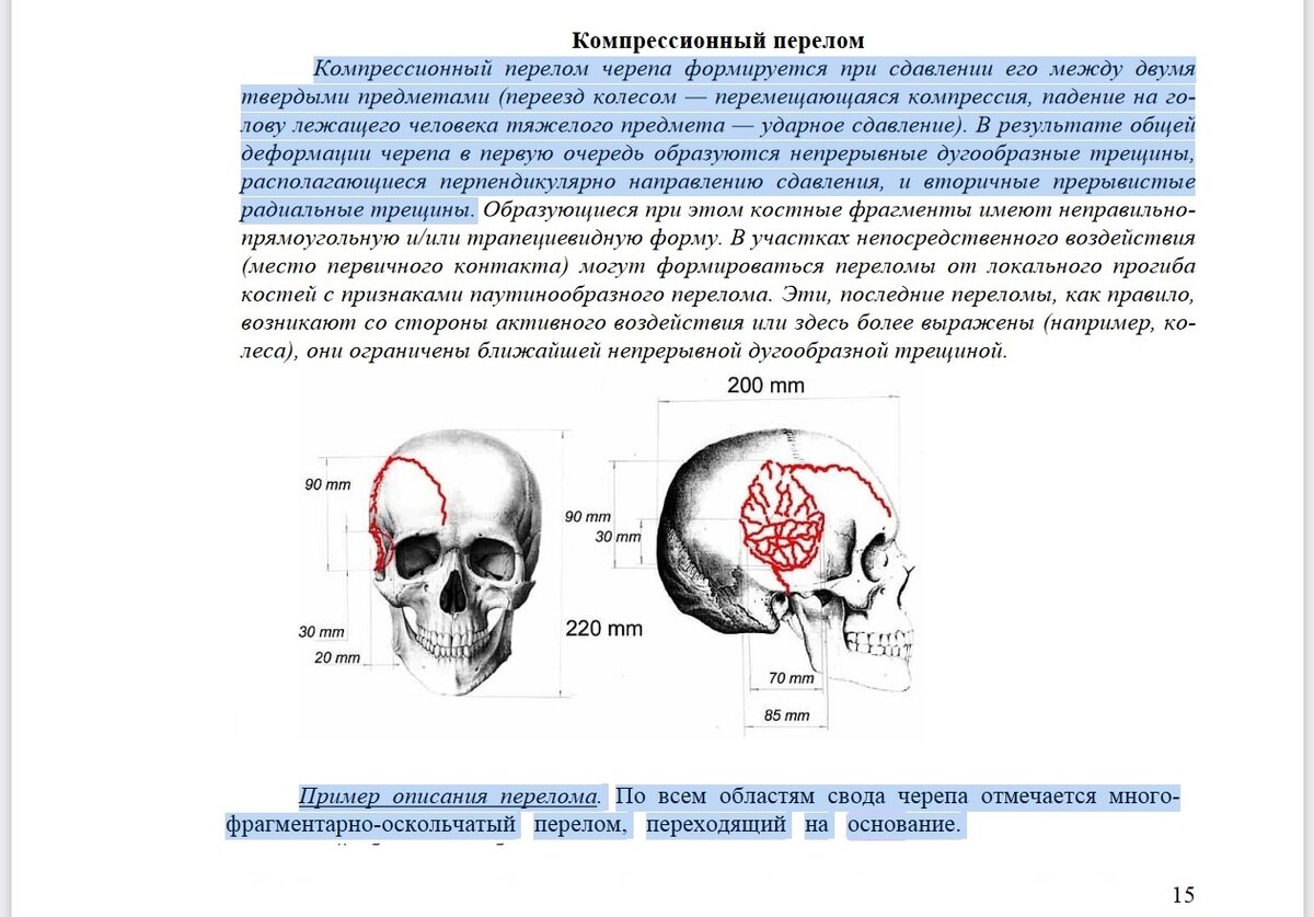 ах какая благодать кожу с черепа снимать | Дзен