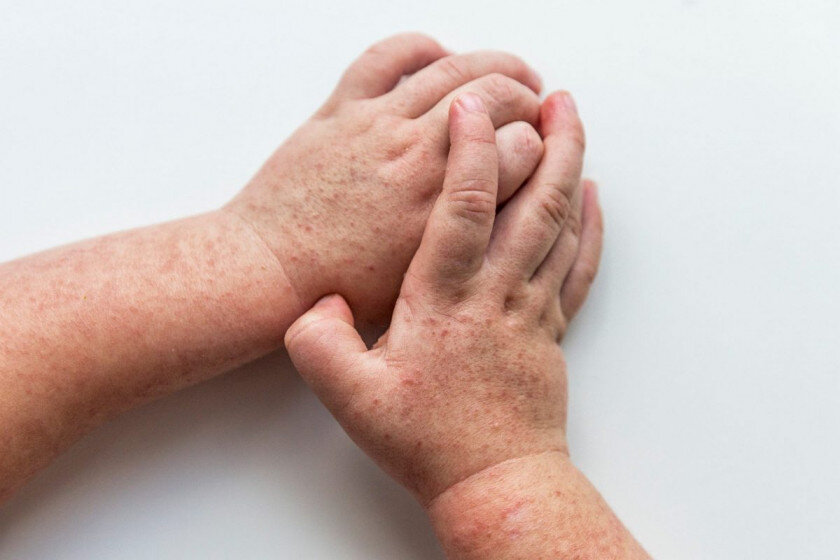   anastasiyaparfenyuk, 123rf