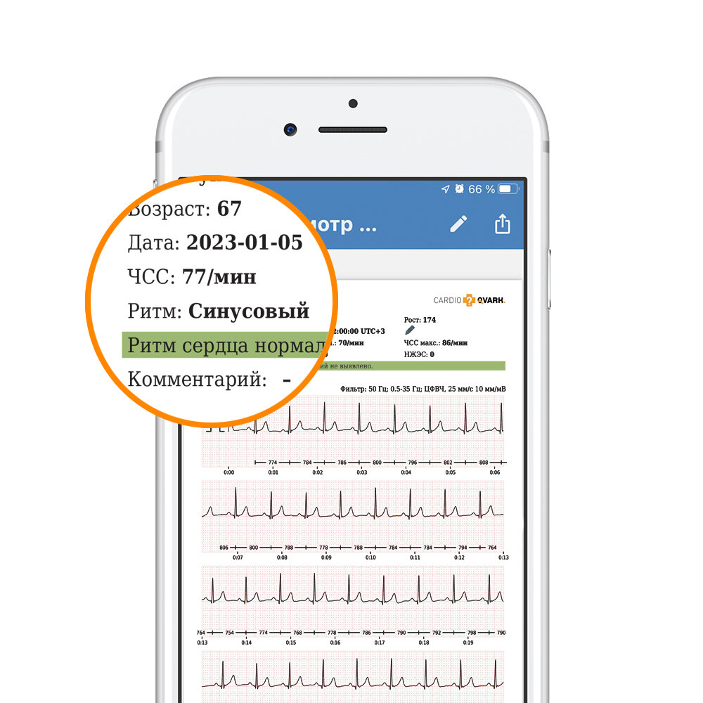 Гаджет cardioqvark. Приложение кардиокарта. Приложение кардиокарта. Ecg dongle. Приложение кардиокарта.