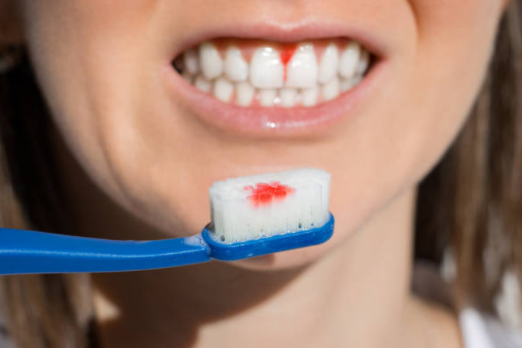 фото: istockphoto.com