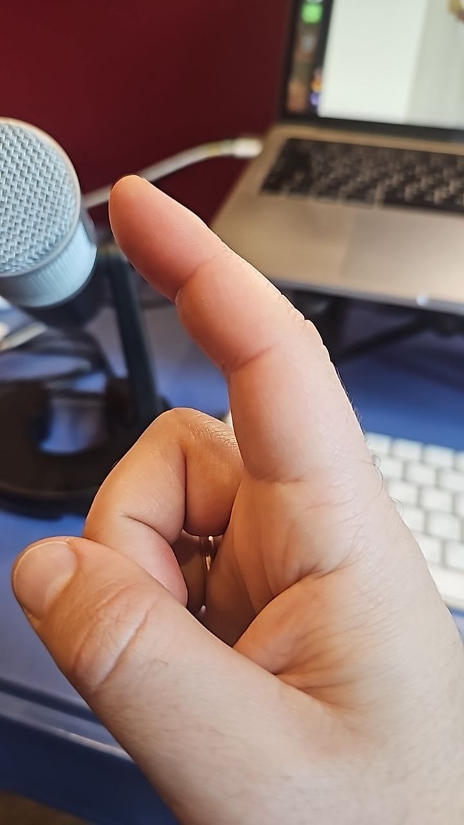 Я смотрю на свой палец