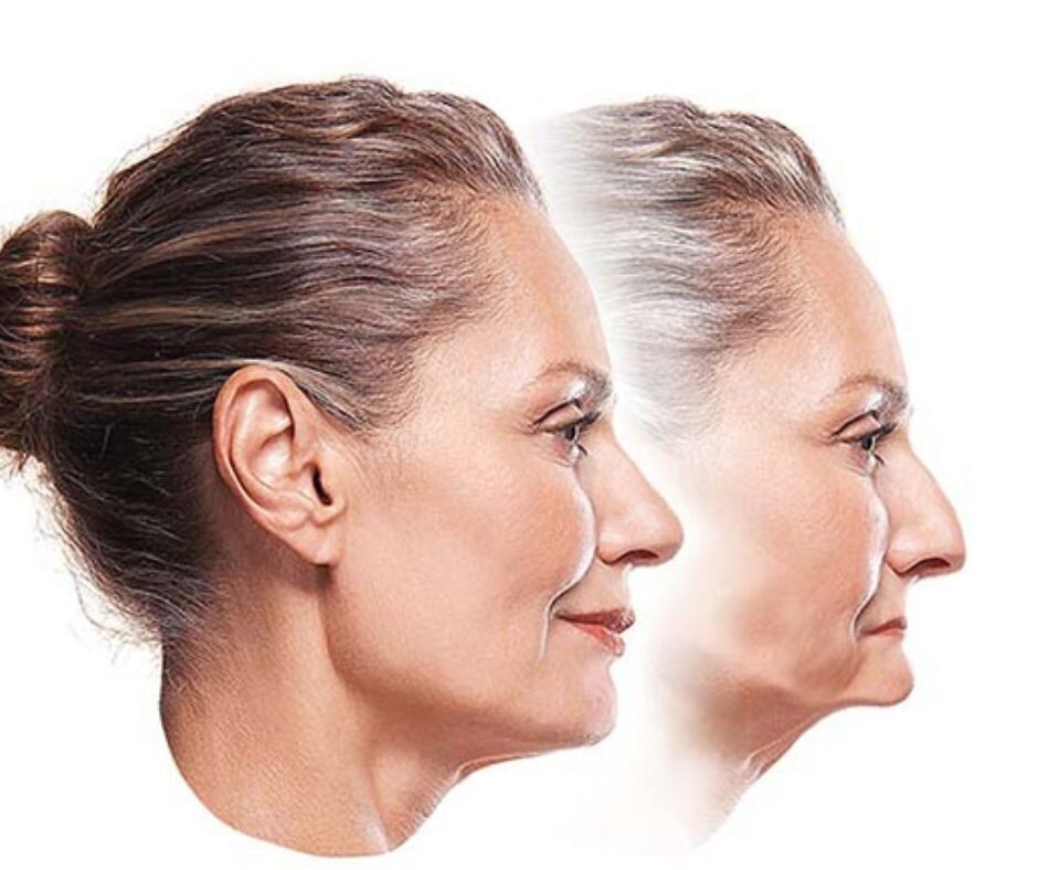 Стареющий внешний вид многих людей, связан с потерей зубов,