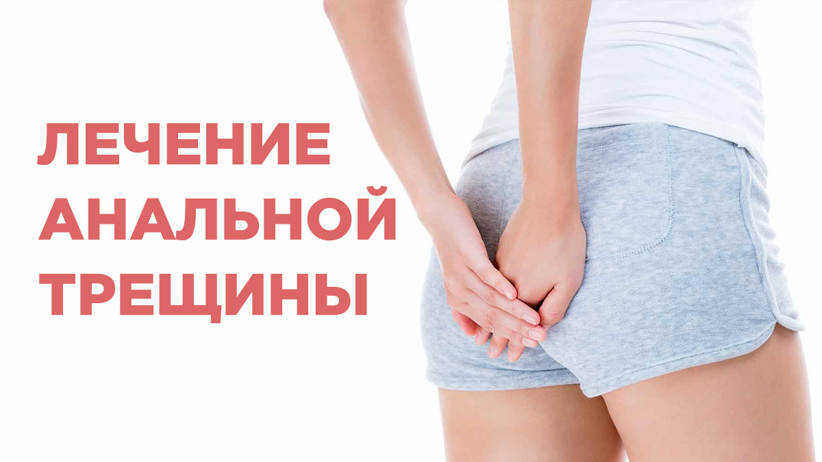 Лечение анальной трещины