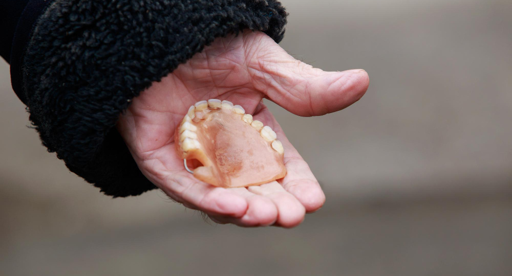 7 советов, как продлить срок службы съемных зубных протезов