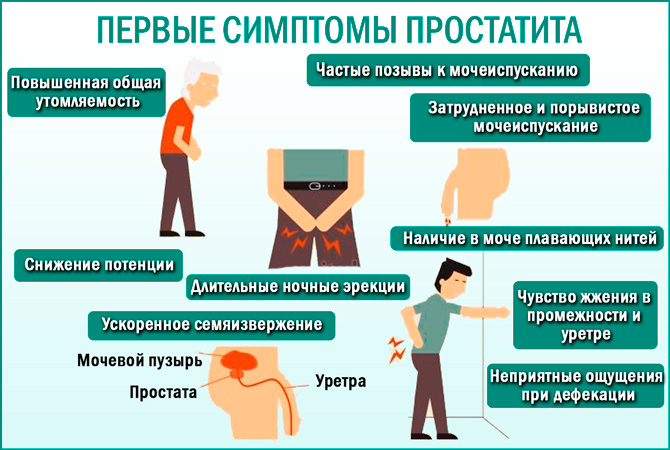 Что такое простатит. Проявление простатита