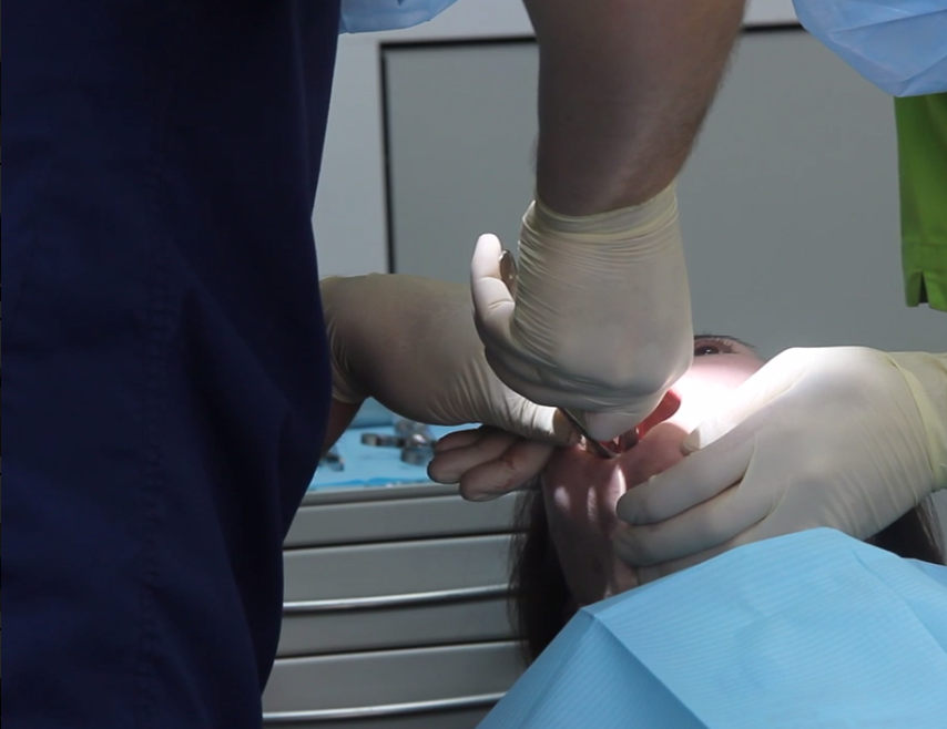 Удаление зуба