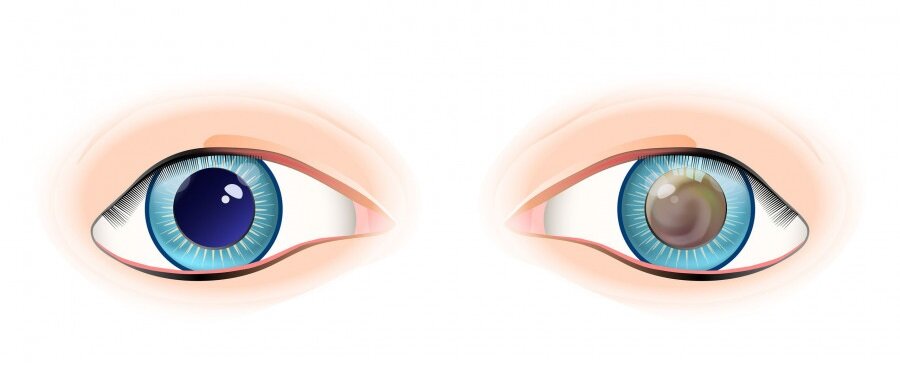 помутнели зрачки