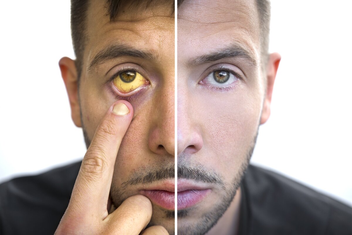  📷 📷 📷 📷 📷   Как выглядят симптомы агрессивного рака