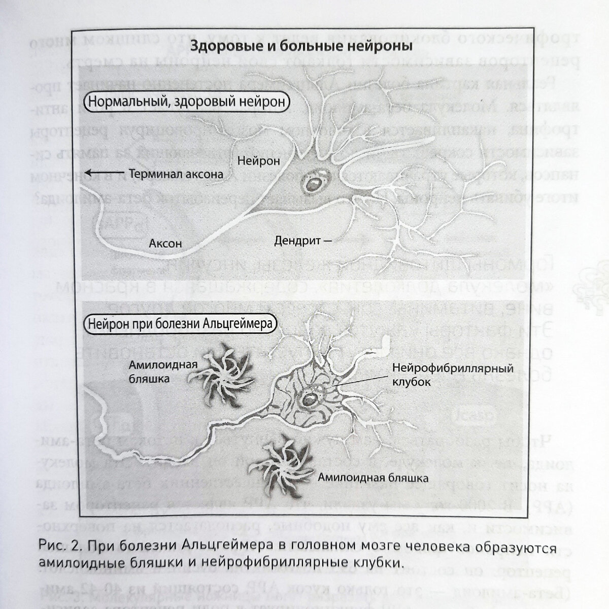 Из книги я также узнала, что можно сдать анализ, который покажет, являешься ли ты носителем формы гена (аллель) под названием ApoE4, который является самым значимым фактором риска развития болезни Альцгеймера. Фото автора