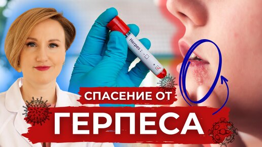 СПАСЕНИЕ ОТ ГЕРПЕСА: Наталья Кондакова Раскрывает Тайны Борьбы! ШОК-Методы