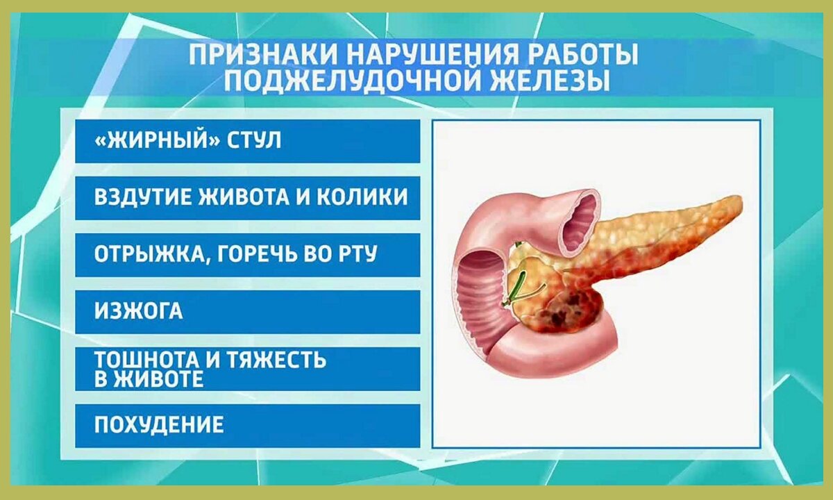 Скоро-скоро Новый год! Как избежать острого панкреатита и других  