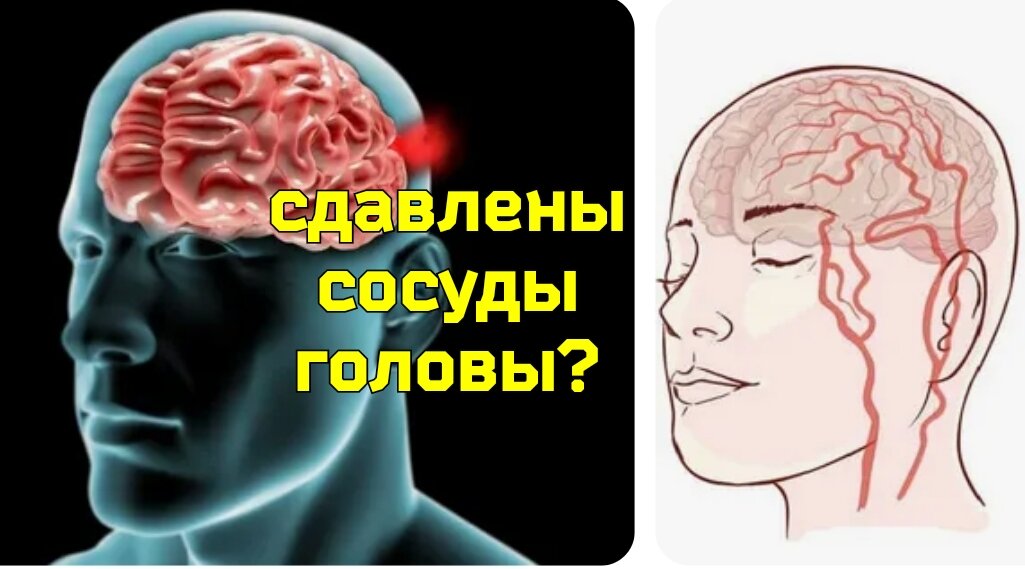 Продукты для улучшения состояния сосудов