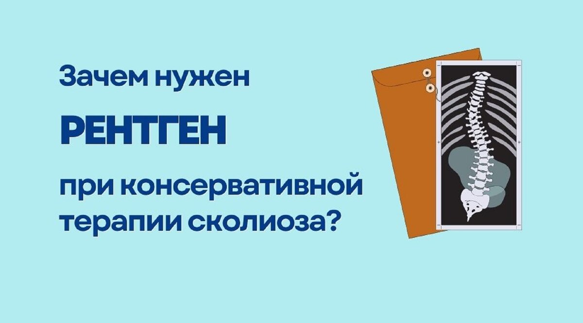 Зачем нужен рентген при консервативной терапии сколиоза?