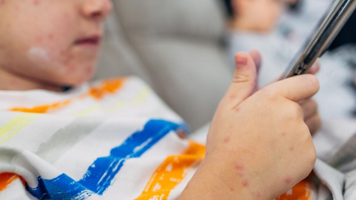    Фото: iStock.com / SBDIGIT Август Макаров