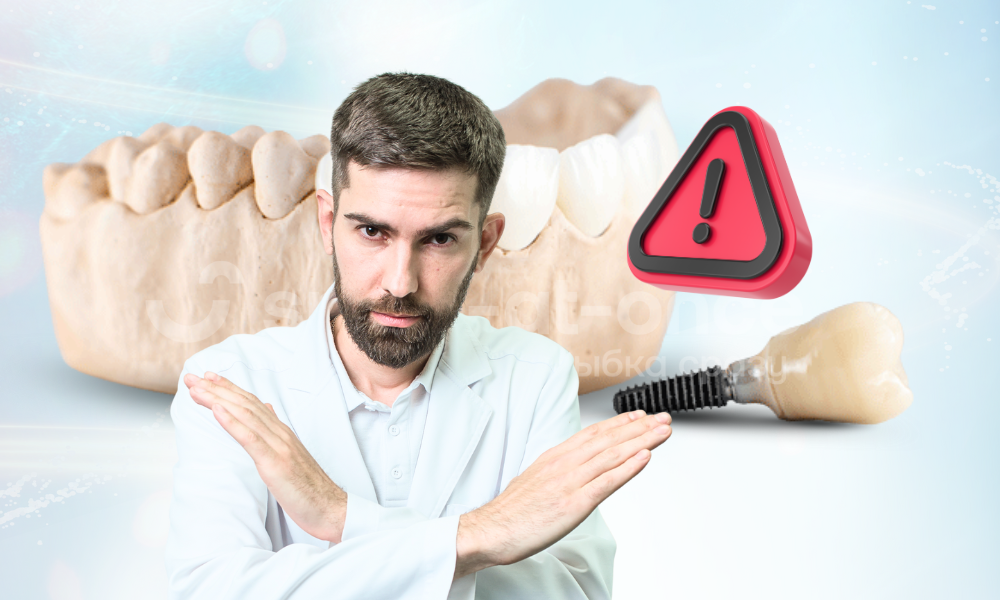 Какие ошибки и поспешные решения могут испортить вам установку зубных имплантов, объясняют врачи клиники Smile-at-Once