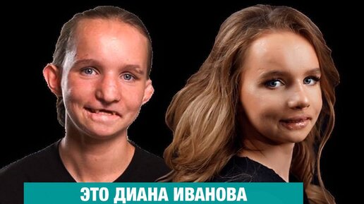 Валентина Иванова взбудоражила подписчиков снимками с обнаженной грудью: видео
