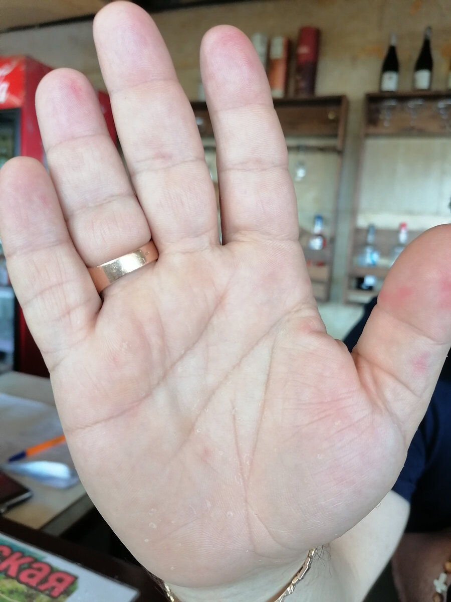 Рука мужчины, 51 год, правша. Абхазец. Все фото из личного архива. 

