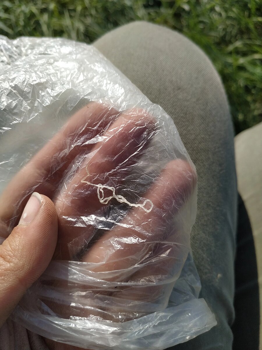  - Dirofilaria repens. Нематода уже слегка усохлась.