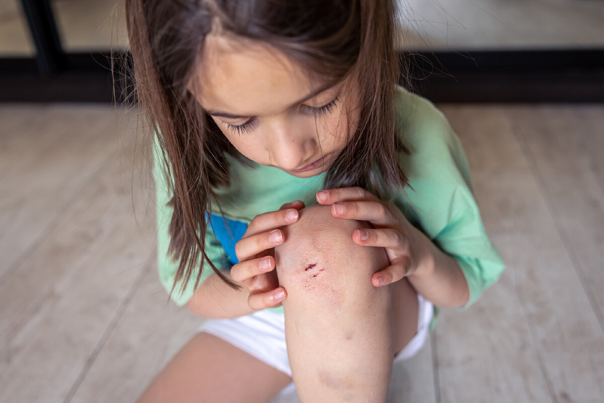 <a href="https://ru.freepik.com/free-photo/closeup-of-little-girl-holding-her-bruised-injured-damaged-knee-with-her-hands_47137342.htm#query=%D0%BC%D0%B0%D0%BB%D1%8B%D1%88%D0%BA%D0%B0%20%D1%81%20%D1%80%D0%B0%D0%B7%D0%B1%D0%B8%D1%82%D1%8B%D0%BC%D0%B8%20%D0%BA%D0%BE%D0%BB%D0%B5%D0%BD%D0%BA%D0%B0%D0%BC%D0%B8&position=10&from_view=search&track=ais">Изображение от pvproductions</a> на Freepik